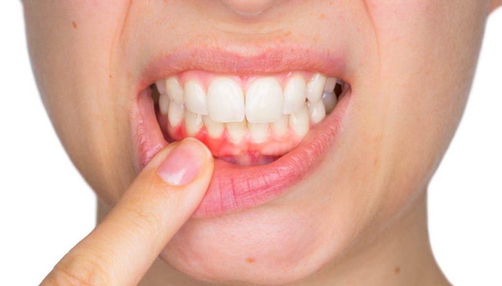 Toothache treatment in Mosinee