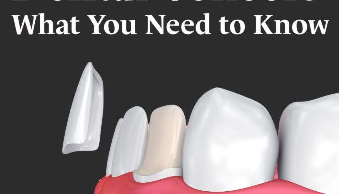 Dental Veneers Mosinee Dentist