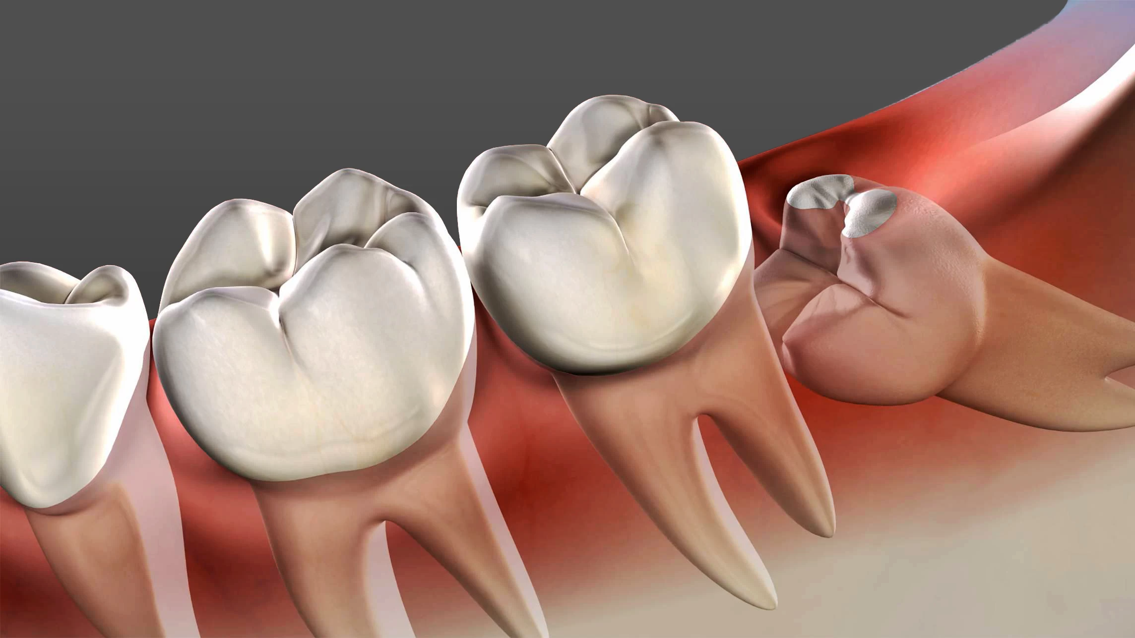 Endodontics Specialists: Comprehensive Root Canal Care