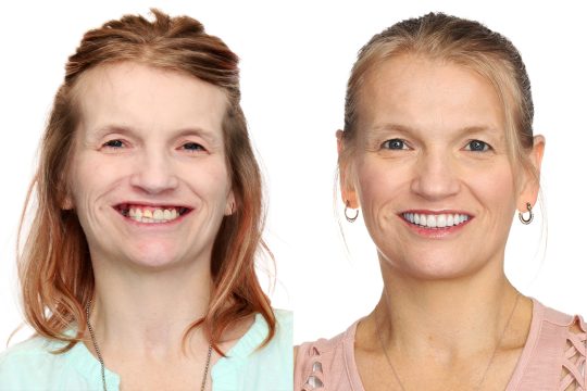 Smile Gallery
