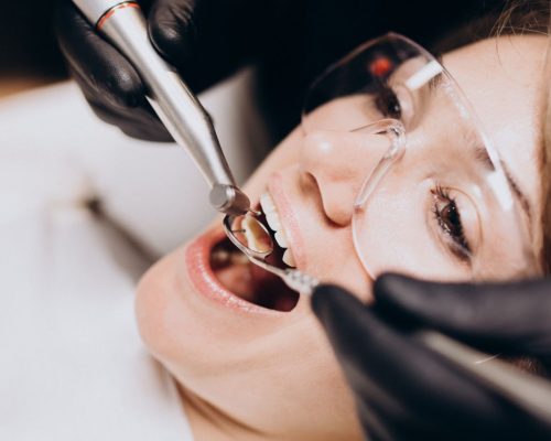 Wisdom tooth removal