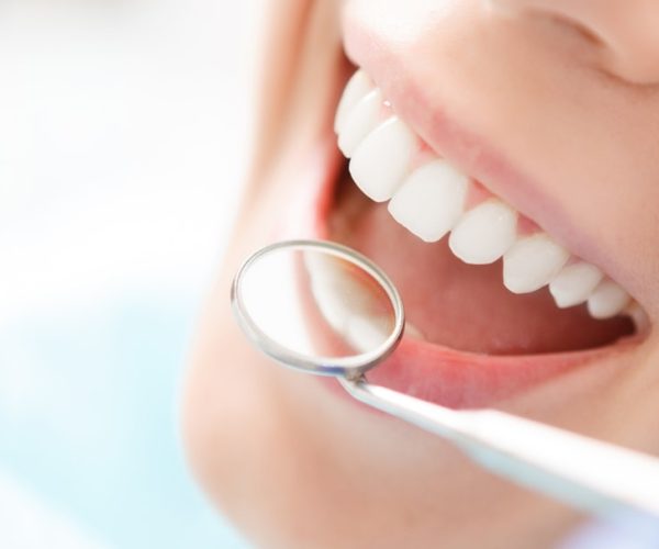 Root Canal Therapy